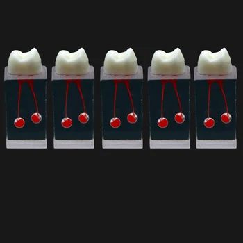 5vnt Dantų Šaknų Kanalų Modelis Bendrosios Praktikos Pulpos Ertmę Dervos Endo Mokymo Priekinį Dantį RCT Mokymo Naudotis