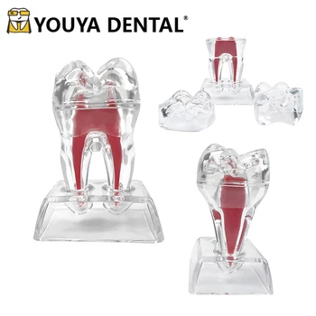 Skaidrūs Dantų Anatomijos Modelis Vieno Danties Irimas Modelių, Dantų Technikas Mokymo Praktika Studijuojant